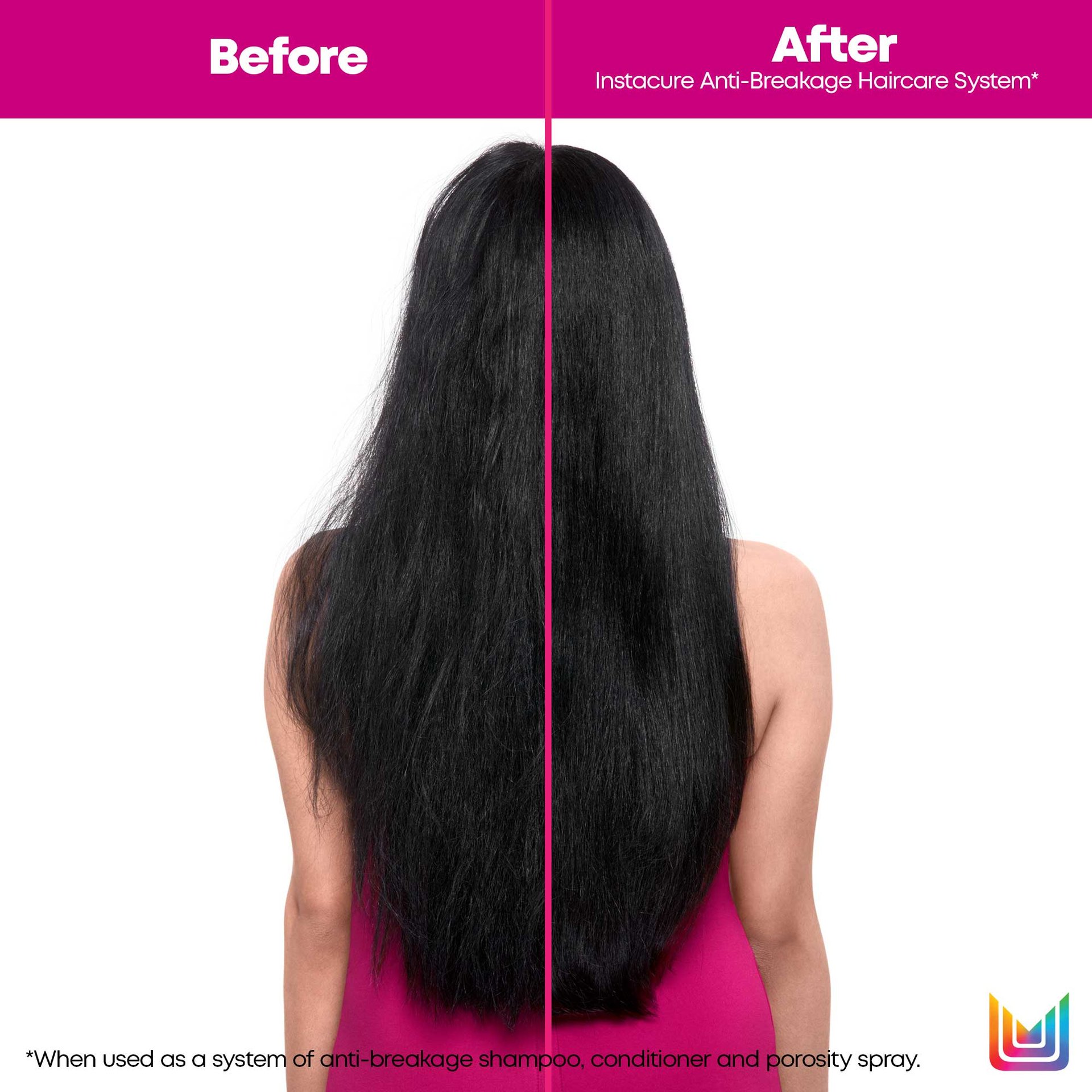 Matrix 2021 Instacure Before After Espi Back no