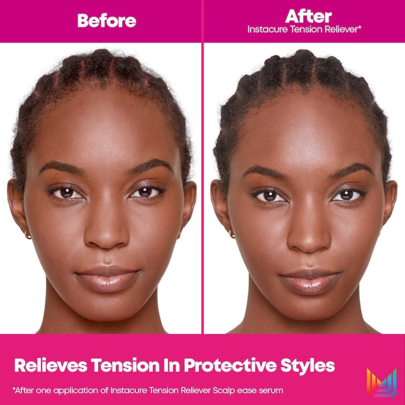 Matrix-2021-Instacure-Before-After-Anzie-Front-2000x2000