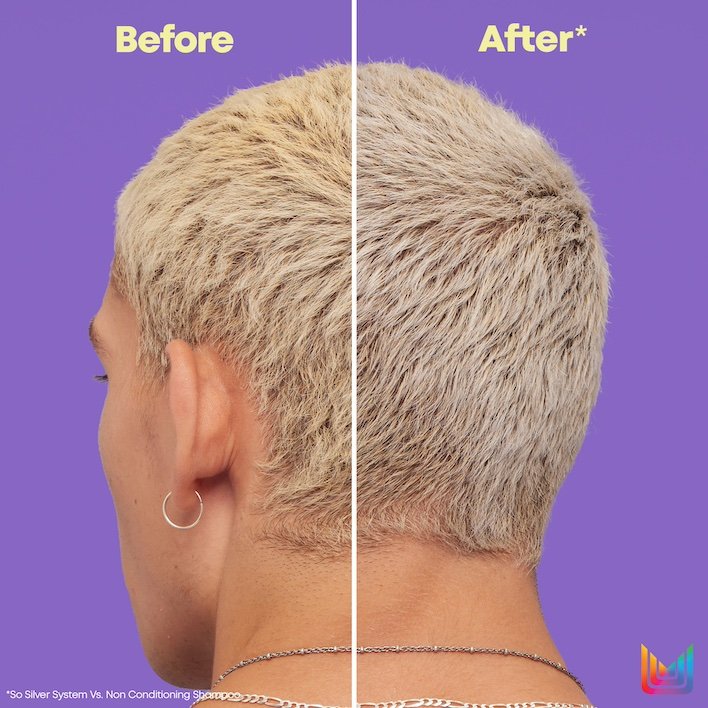 before after 2
